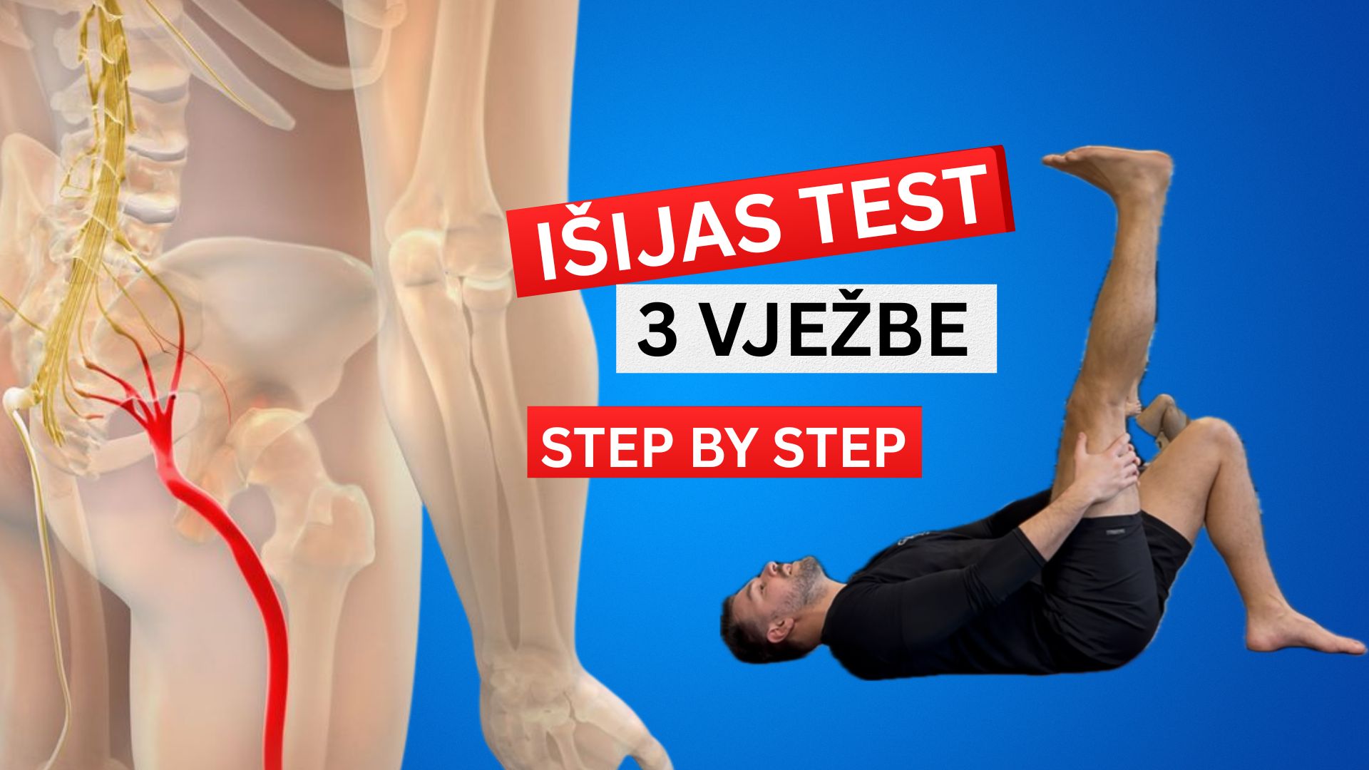 Išijas: Test + 3  vježbe